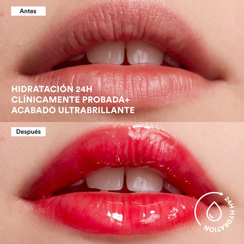 Load image  in gallery view